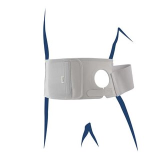 STOMACARE Band.EasyOp.Pl.315 72mm H15 re.M grau | BHS3157204R-M | PZN 17905662